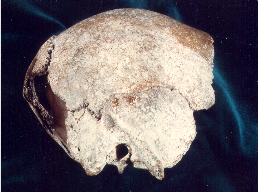Schdelfragment des Homo erectus reilingensis
