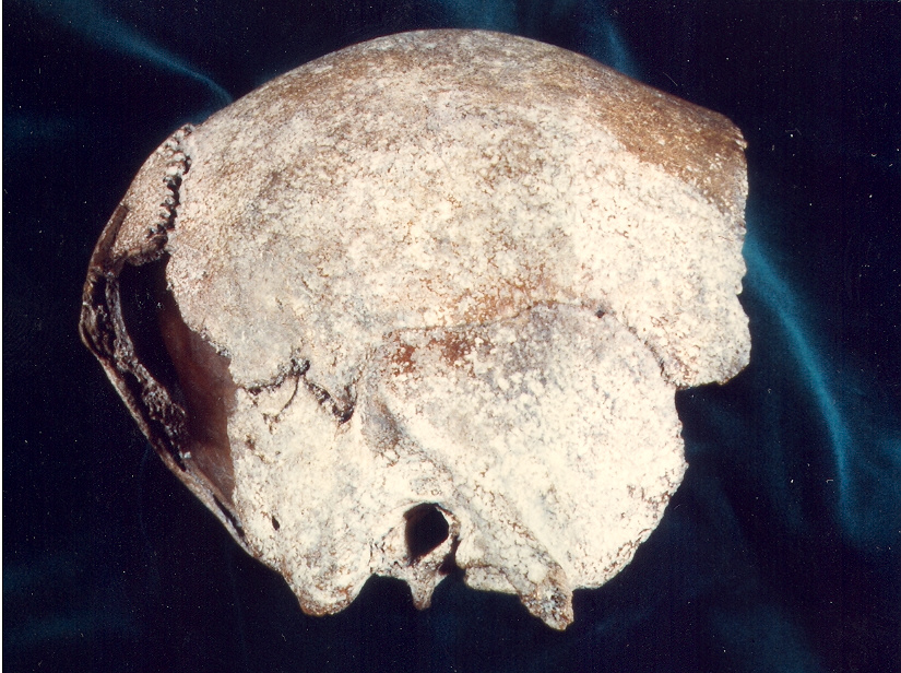 Schädelfragment des Homo erectus reilingensis